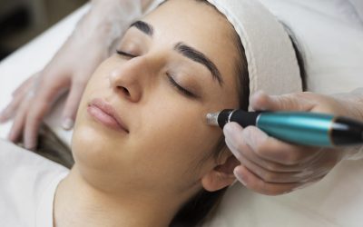 person-getting-micro-needling-beauty-treatment