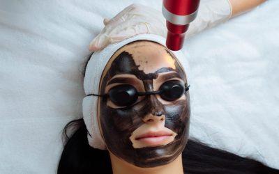Close-up of cosmetologist's hand making hardware carbon peeling by young pretty customer woman in safety glasses headdress lying on couch in beauty salon. Facial cleaning concept. Cosmetology Services.